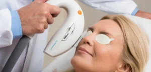 laser treatment for skin pune