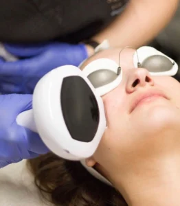 laser treatment for skin pune
