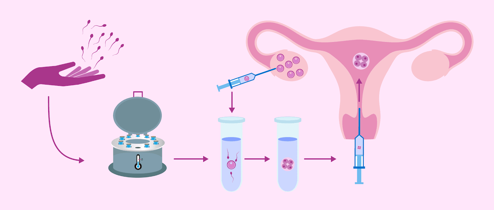 How Fertility Centers Support Couples with Recurrent Pregnancy Loss?