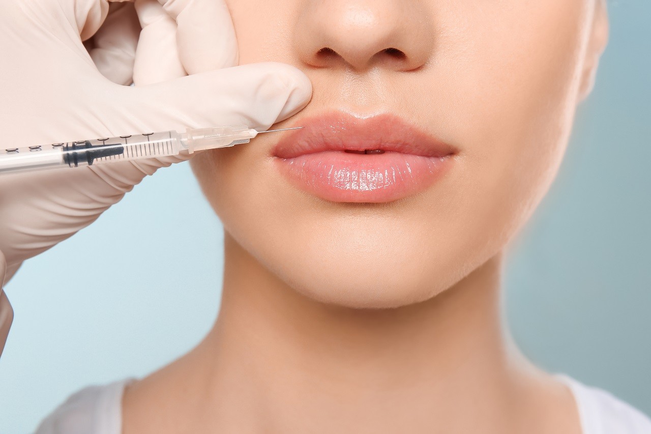 Botox-Lip Flip: Verschönern Sie Ihr Lächeln mit dezentem Volumen