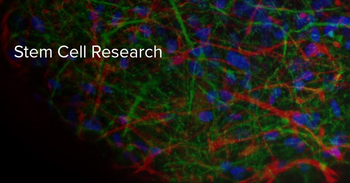 Europe Stem Cell Assay Market Size, Share, Growth, Report 2032