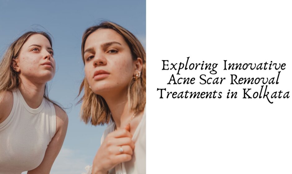 Exploring Innovative Acne Scar Removal Treatments in Kolkata