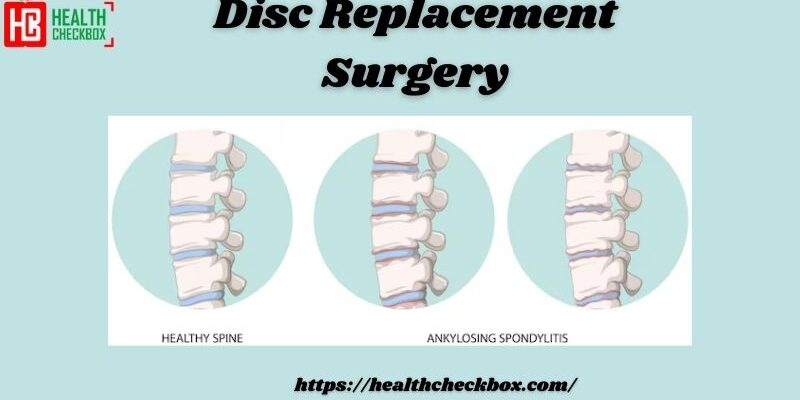 Disc Replacement Surgery