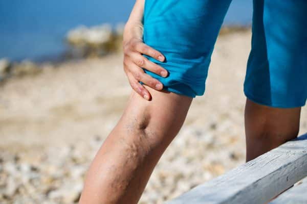 vein treatment doctors