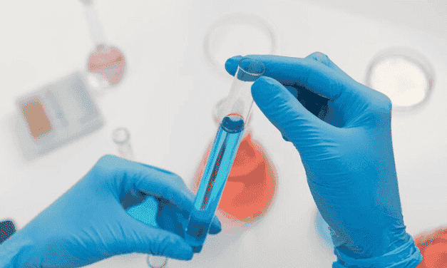 lipid profile test