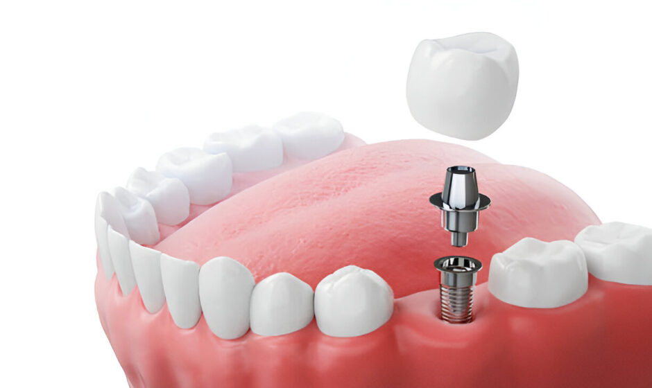 dentist in the Scottish Borders