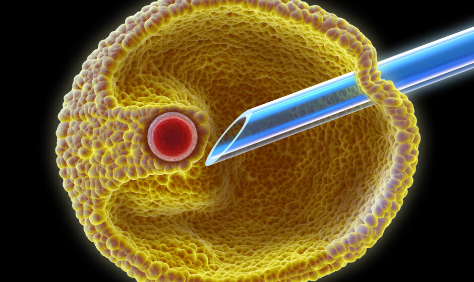 IVF Treatment