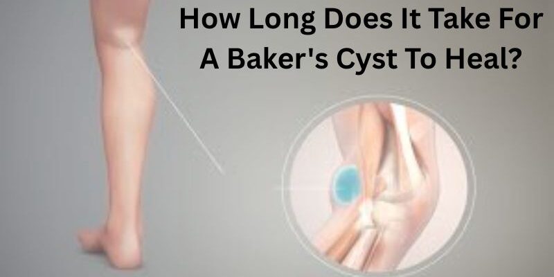 Bakers-Cyst-