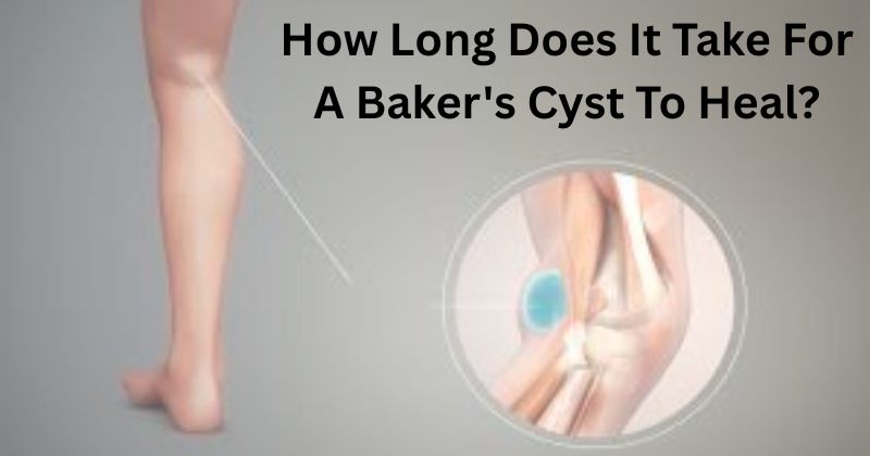 Bakers-Cyst-