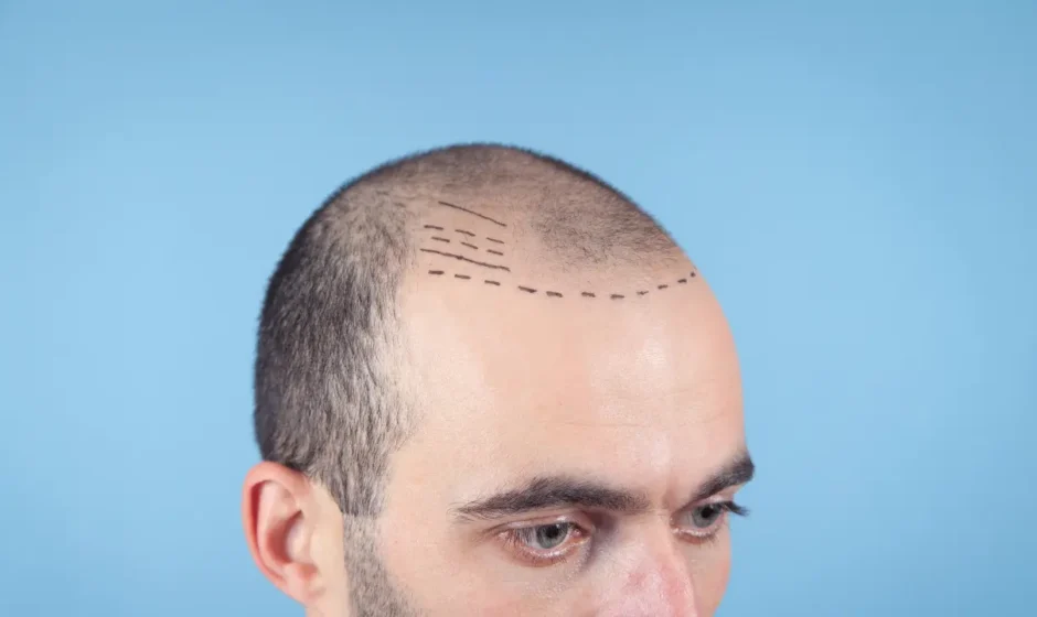 hair clinic london