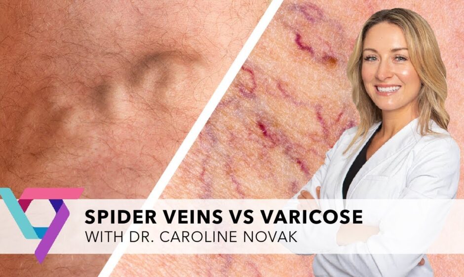 what kind of doctor is a vein specialist
