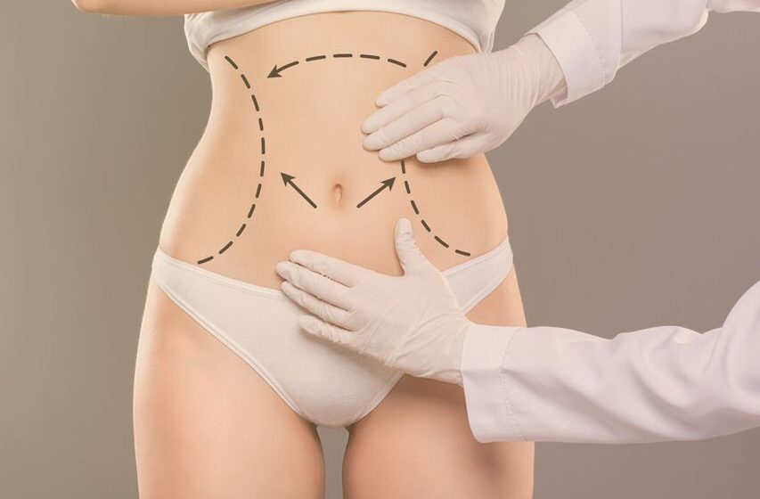 tummy tuck surgery in Dubai