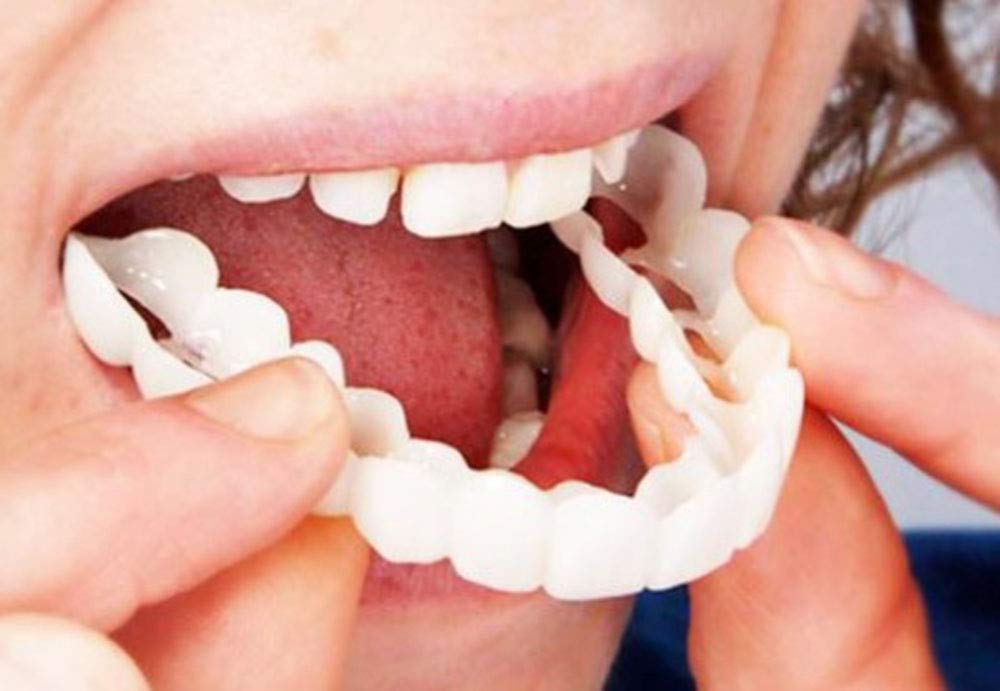What Are the Benefits of Choosing Snap-On Smile?