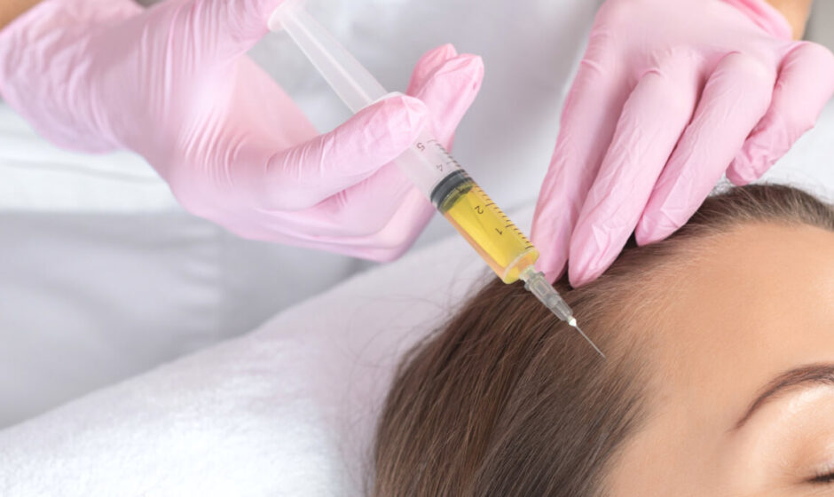 The Pros and Cons of PRP for Hair Loss
