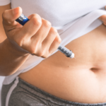 BBL vs. Implants: Choosing the Right Buttock Augmentation Procedure for You
