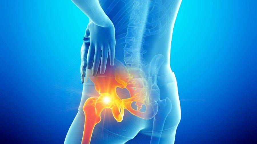 Hip Replacement Surgery in Jaipur