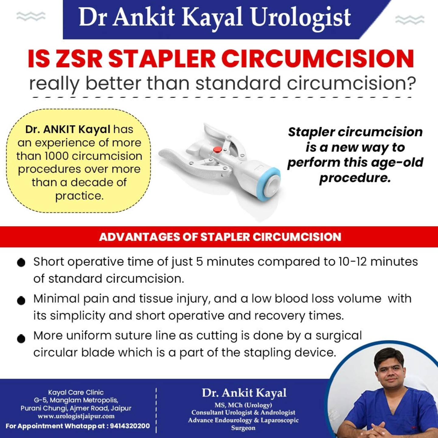 Laser Treatment for Kidney Stones: Is It Right for You?