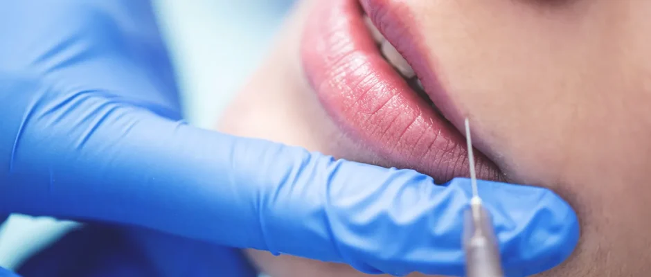 Botox in Alexandria