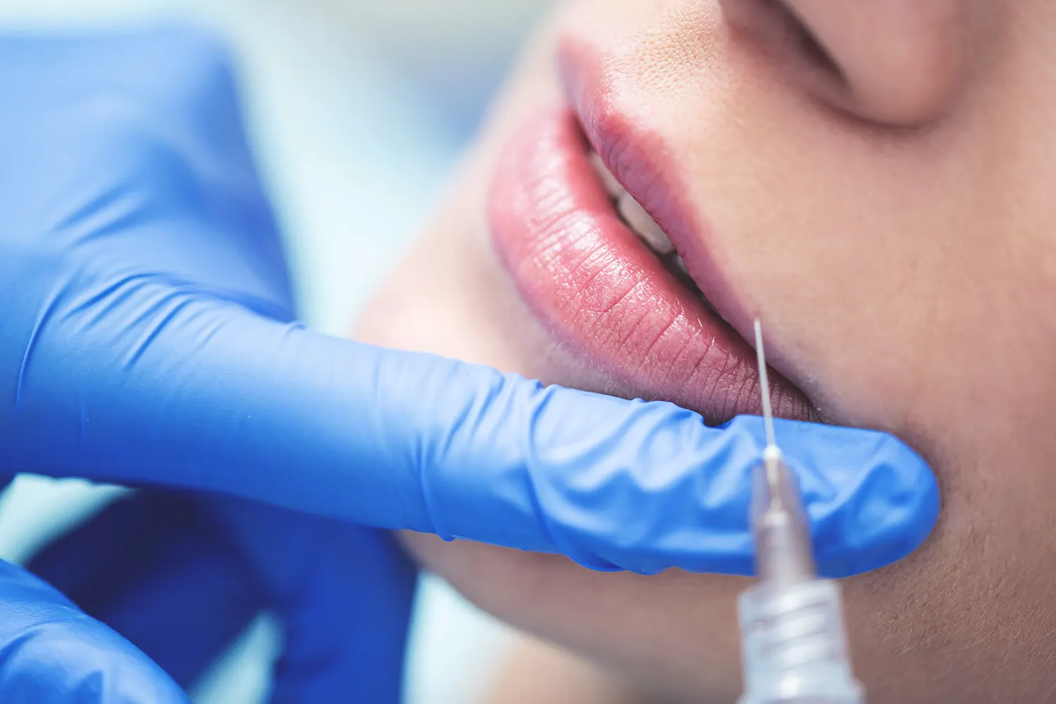 What Are the Benefits of Botox in Alexandria?