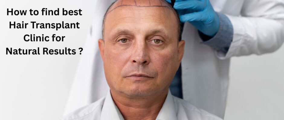 How to find best Hair Transplant Clinic for Natural Results ?