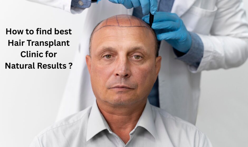 How to find best Hair Transplant Clinic for Natural Results ?