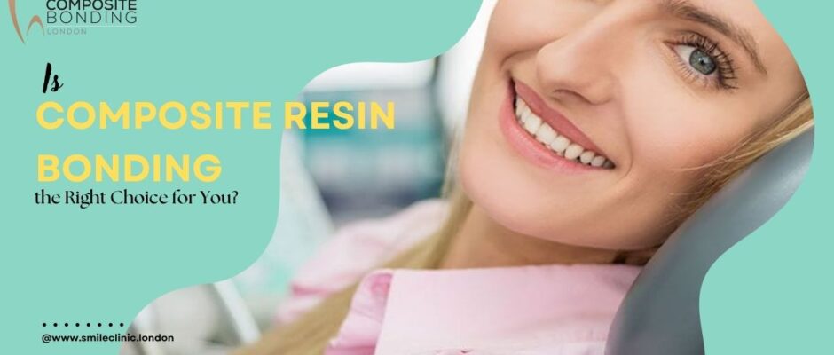 '16 teeth composite bonding London'