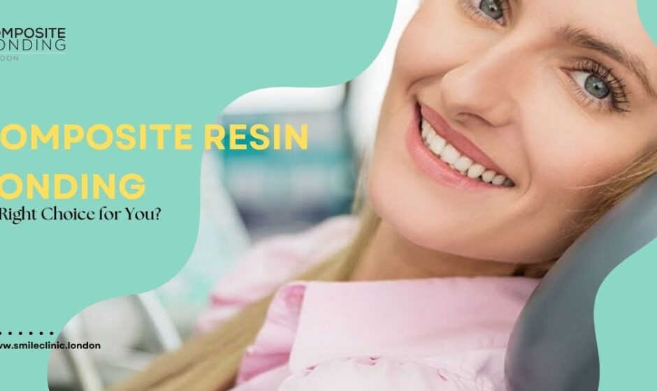 '16 teeth composite bonding London'