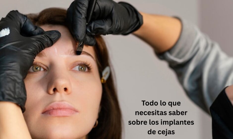 Todo lo que necesitas saber sobre los implantes de cejas