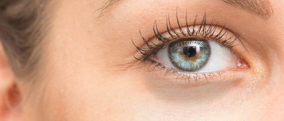 Is Your Skin Ready for Dark Circles Treatment?