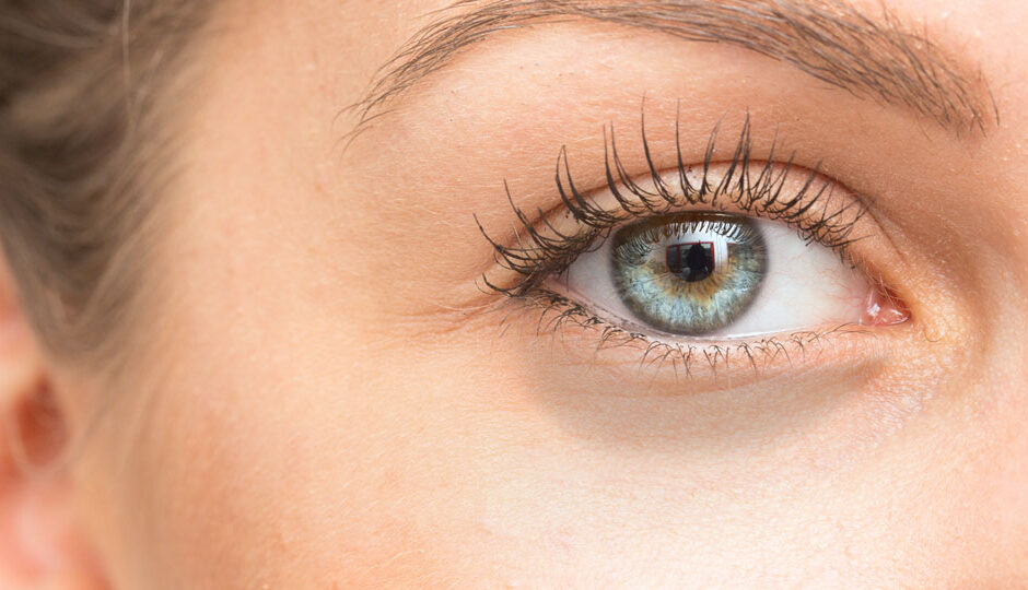 Is Your Skin Ready for Dark Circles Treatment?