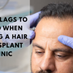 Stem Cells Treatment in Dubai: Revolutionizing Healing and Rejuvenation