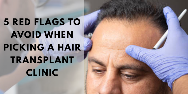 hair transplant clinic
