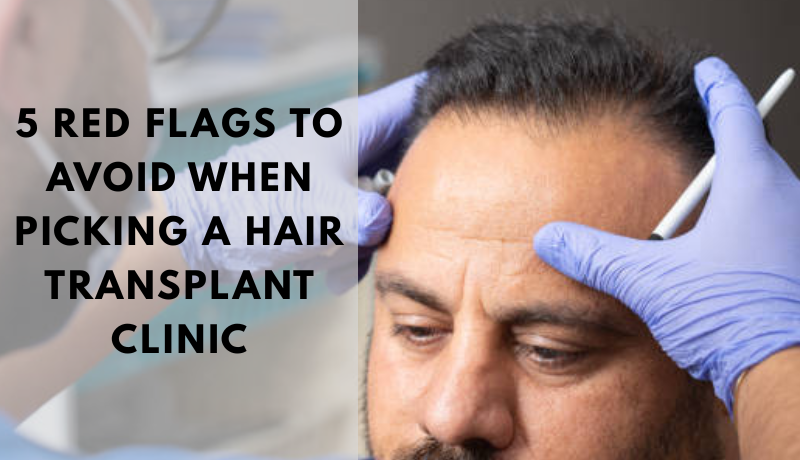 hair transplant clinic