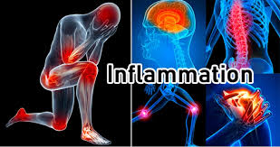 manage inflammation pain