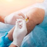 Treating Spider Veins in Dubai: What You Need to Know