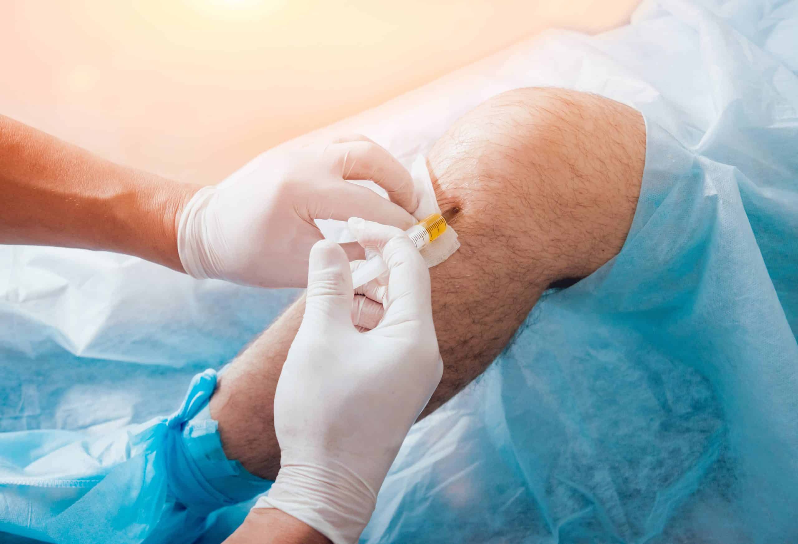 Can Knee Pain Specialists Prevent Surgery?