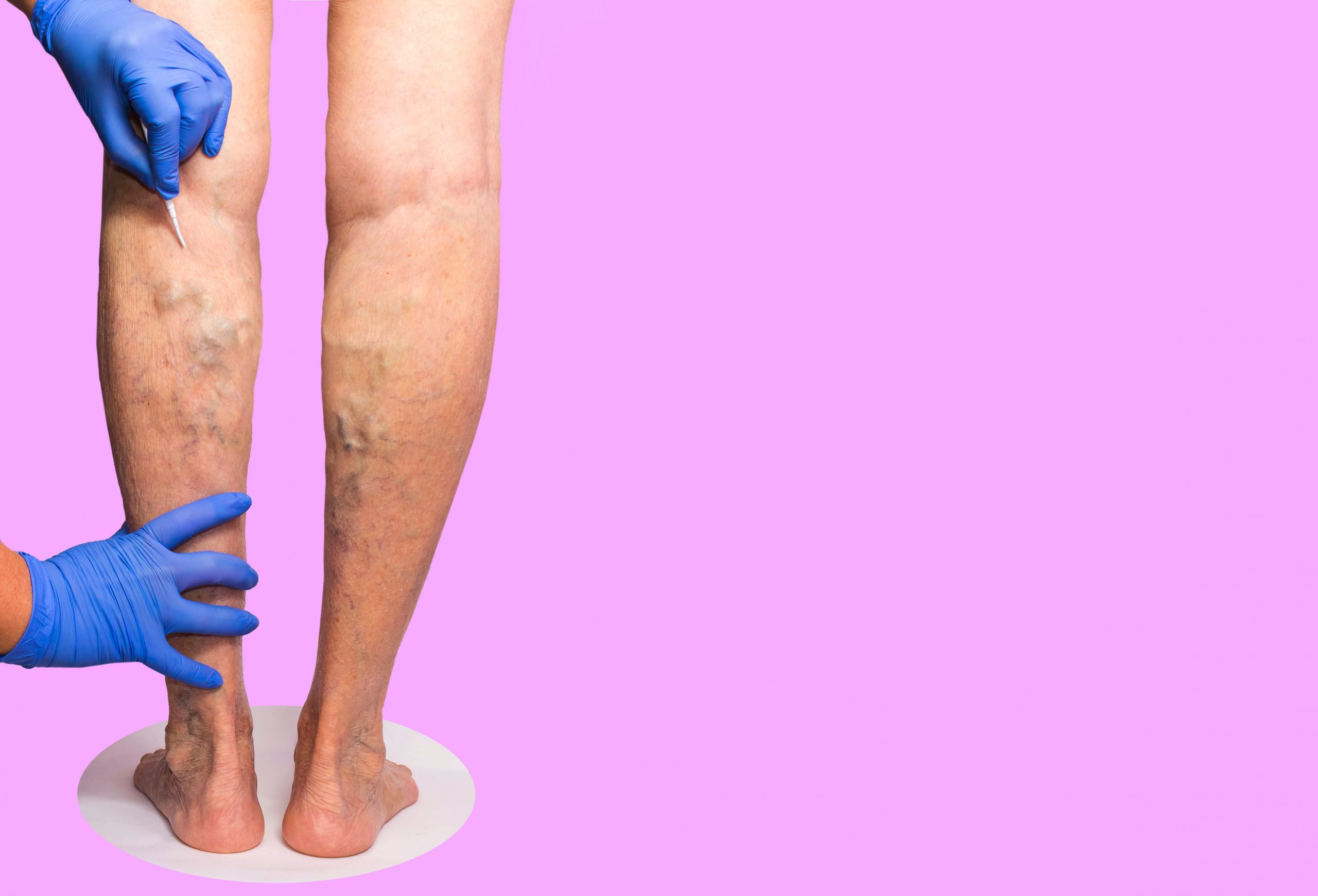 Should You See a Vascular Specialist for Poor Circulation?