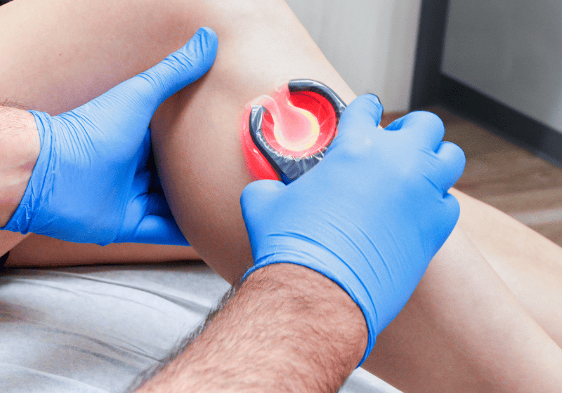 what to expect at a vein clinic