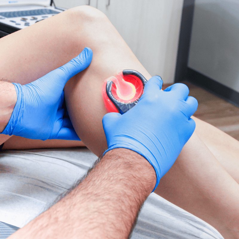 What Types of Tests Are Commonly Performed at a Vein Clinic?